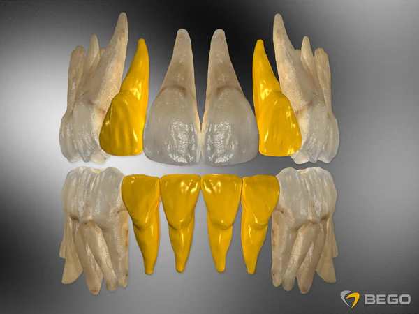 BEGO Semados Implant Tipure Plus..RSX 3.0 L10 Implant