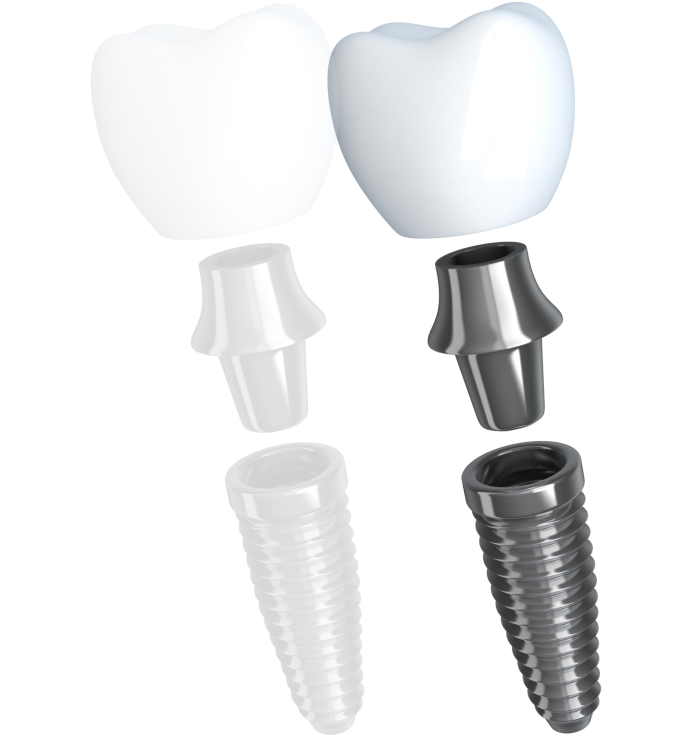 Implants